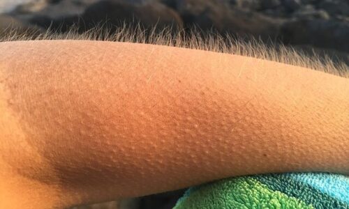 Goosebumps Moments